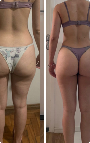 Resultado da paciente