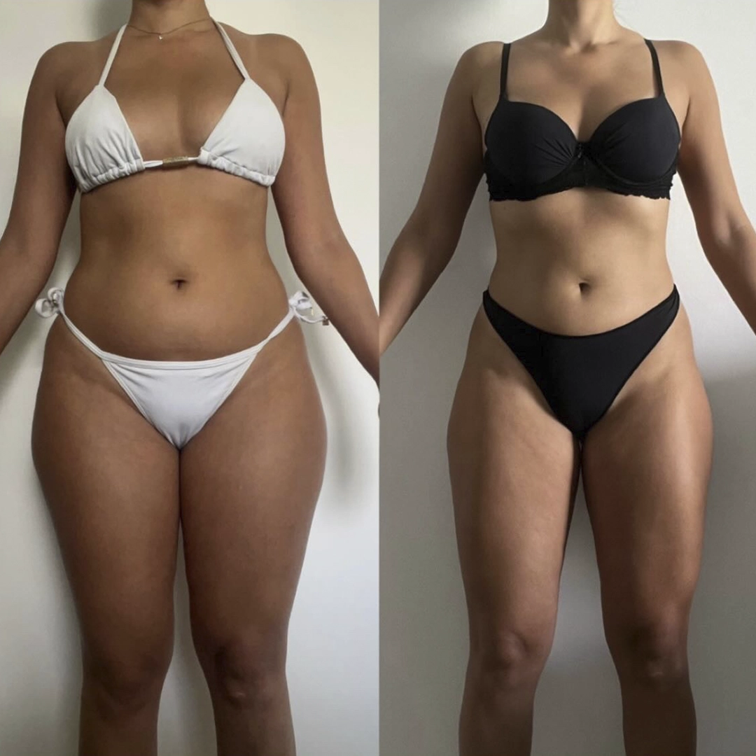 Depoimento Carla - Resultado -12 cm