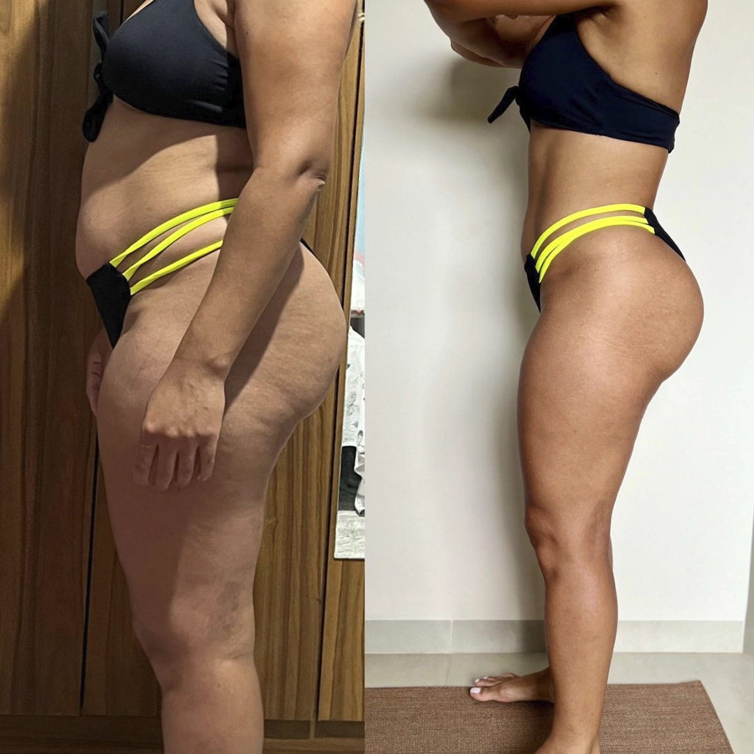 Depoimento Juliana - Resultado -14 cm