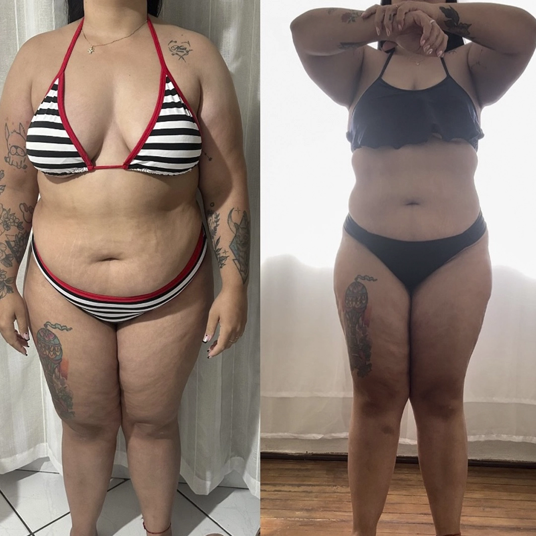 Depoimento Patrícia - Resultado -10 cm